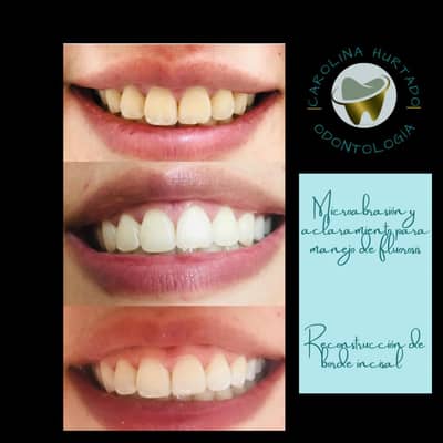 Slider image (1) Carolina Hurtado Odontologia Integral in Bogota, Colombia